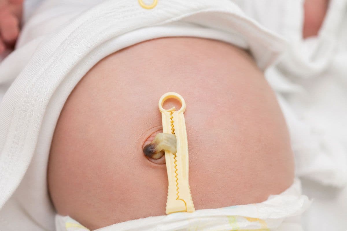 El cordón umbilical del recién nacido: cómo cuidarlo